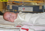 Premature Baby Frieda Mangold